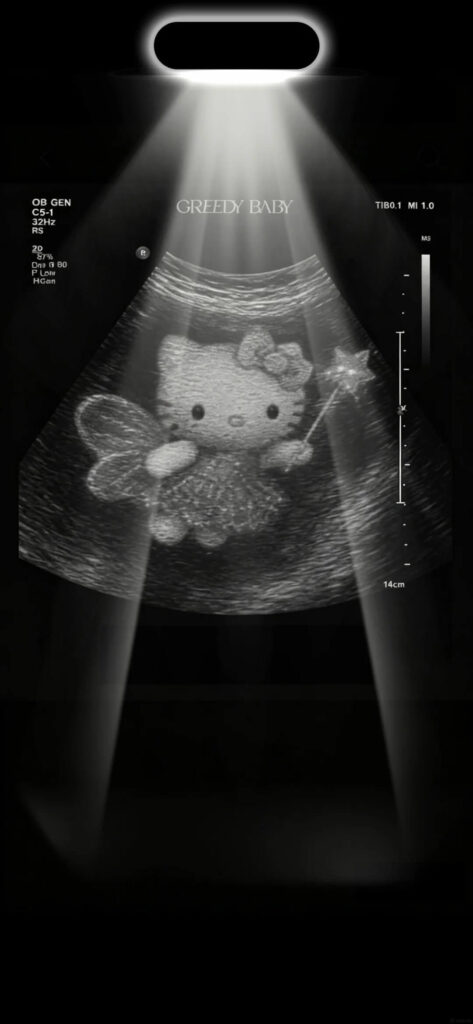 250+ Hình Nền Điện Thoại Hello Kitty Đẹp, Cute, Mới Nhất 2026 20 Ảnh Hello Kitty vô tri, lầy lội làm hình nền cho smartphone
